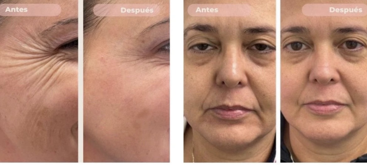 REAFIRMANTE FACIAL REDUCTOR DE PAPADA